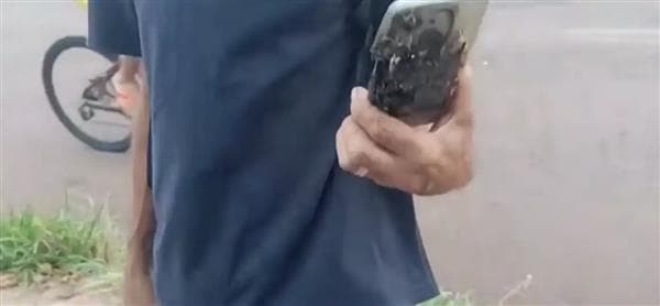 البرازيل.. انفجار هاتف في الجيب ينقذ رجل من هجوم كلاب شرسة