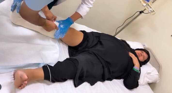 كسر في ساق فيفي عبده