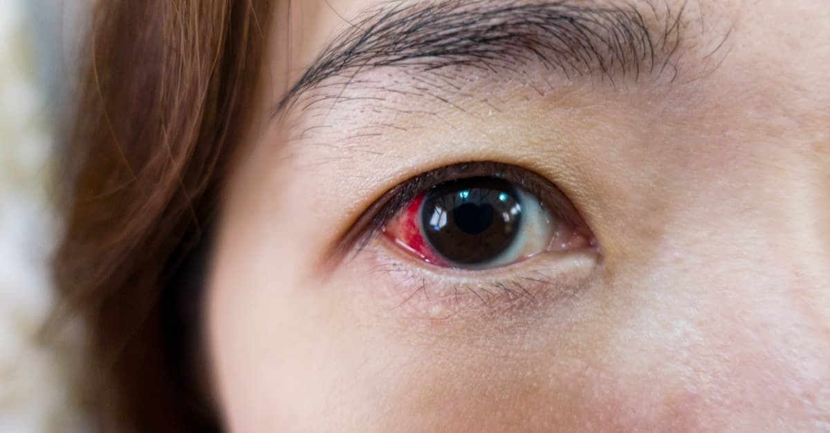 3 فئات معرضة لانفصال الشبكية