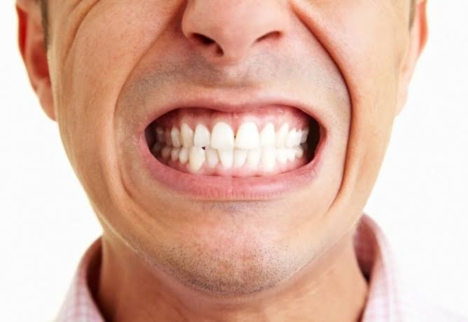 صرير الأسنان.. لماذا يحدث وكيف تحمين أسنانكِ من التآكل؟